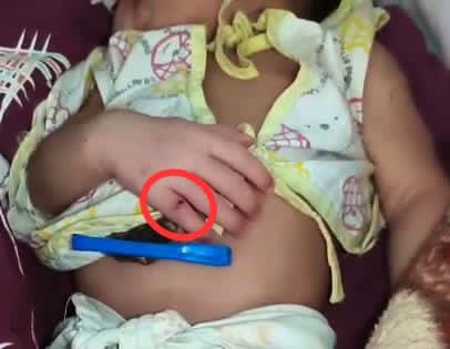 नवजात को चूहे ने काटा या स्वास्थ्य व्यवस्था को लग गया जंग?  गाडरवारा सिविल अस्पताल में कथित घटना से हड़कंप, नवजात की सुरक्षा पर उठे गंभीर सवाल